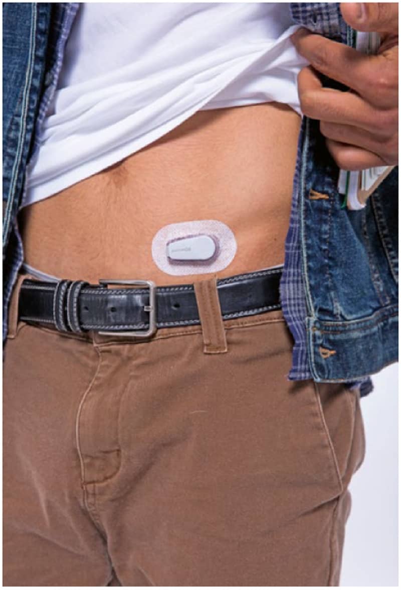 Kontinuierliches Glukosemonitoring erhöht Lebensqualität von Diabetikern