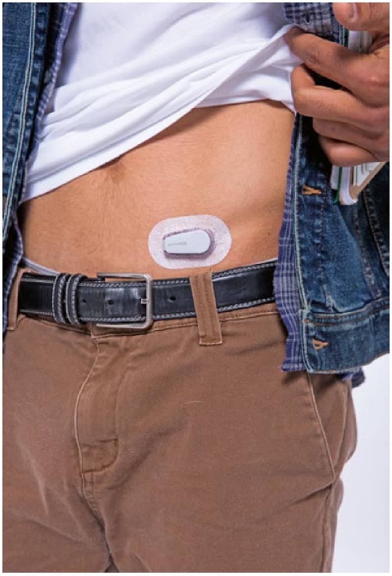 La mesure du glucose en continu (CGM)